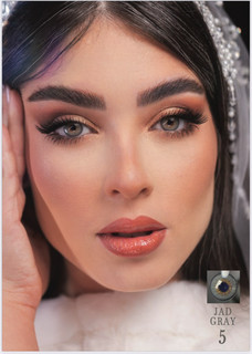 لنز کره ای آی ریو ۶ماهه